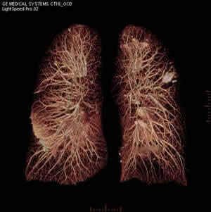 肺の内部